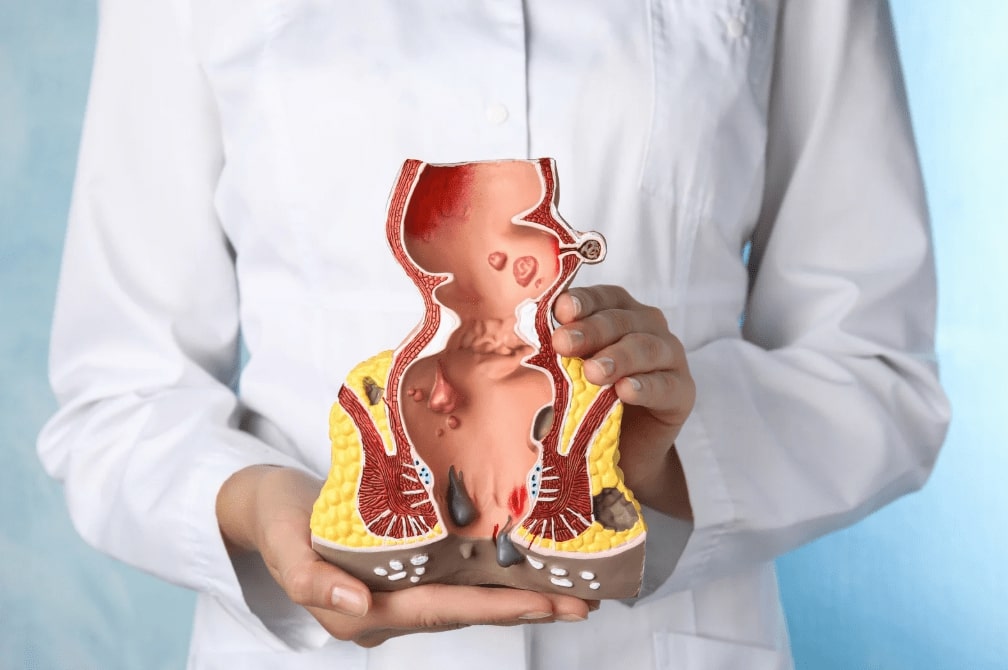 Proctologie